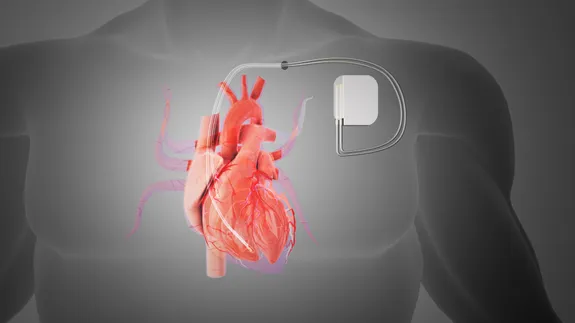 A image of a battery next to a heart in a mock up image of a body