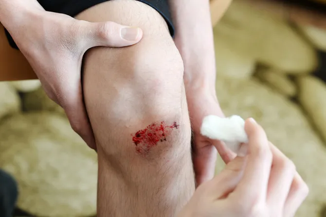 A small wound on a man's knee