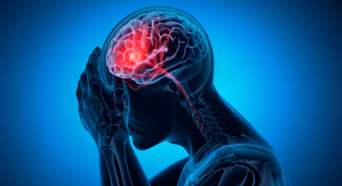 Person with brain injury