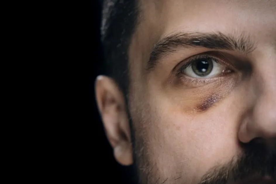 Male domestic abuse resized.jpg