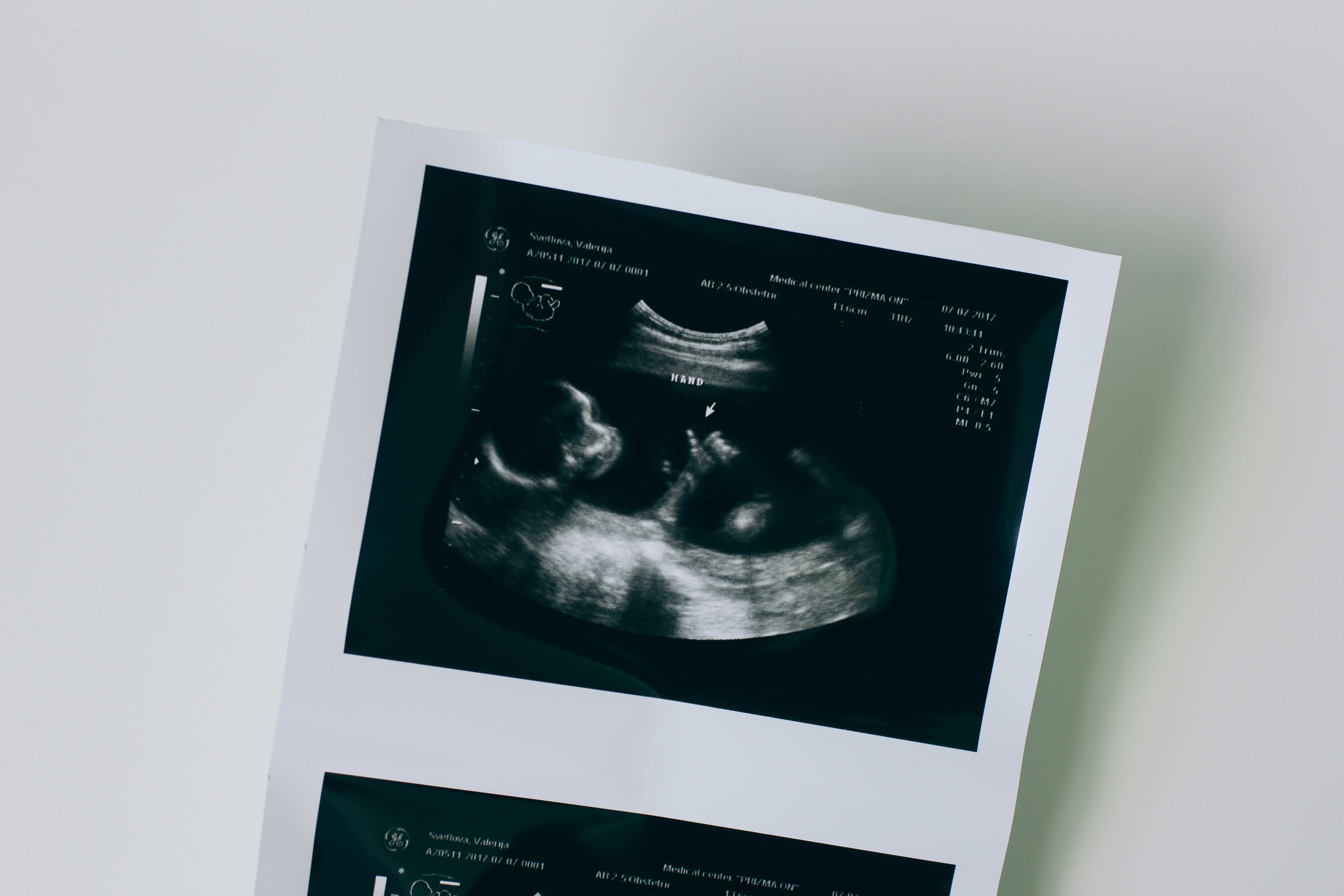 ultrasound image